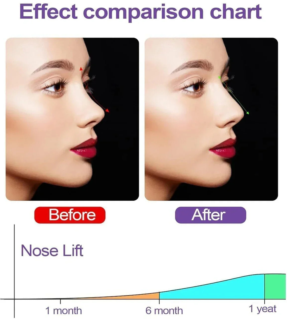 Silicone Nose Corrector Device for Lifting