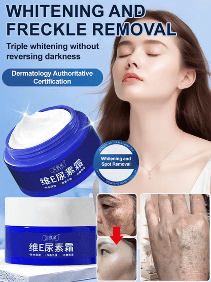 Beautykomi Spot Fading Urea Cream