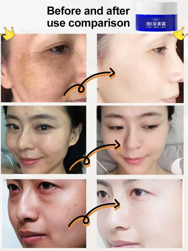 Beautykomi Spot Fading Urea Cream