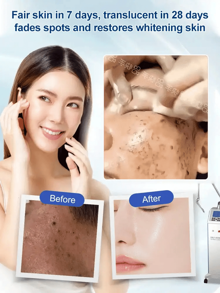 Beautykomi Spot Fading Urea Cream