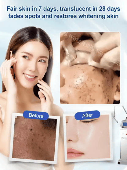 Beautykomi Spot Fading Urea Cream