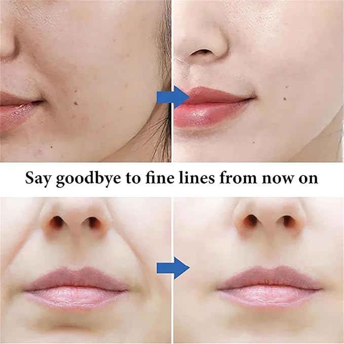 Beautykomi Spot Fading Urea Cream