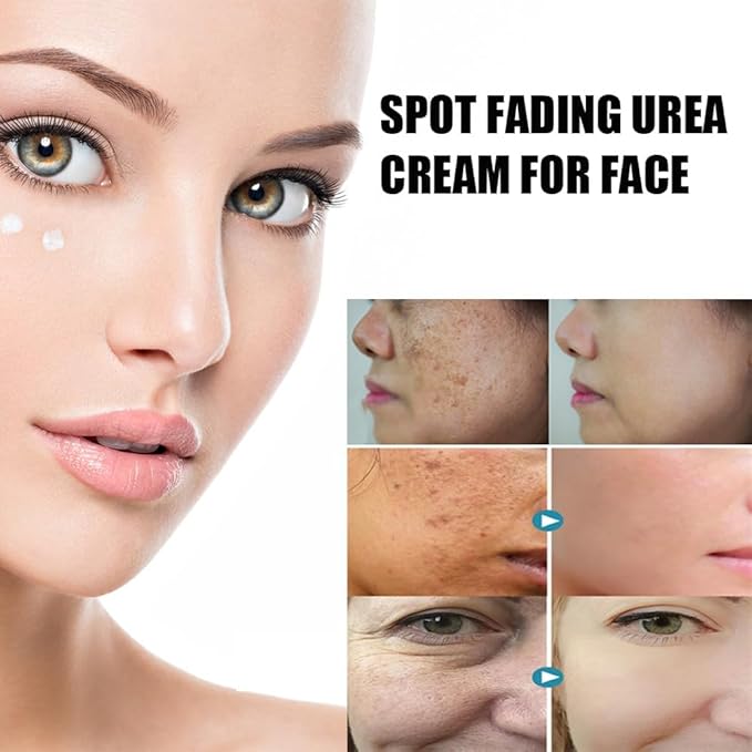 Beautykomi Spot Fading Urea Cream