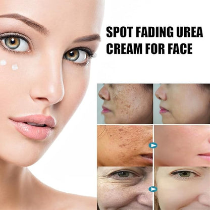 Beautykomi Spot Fading Urea Cream