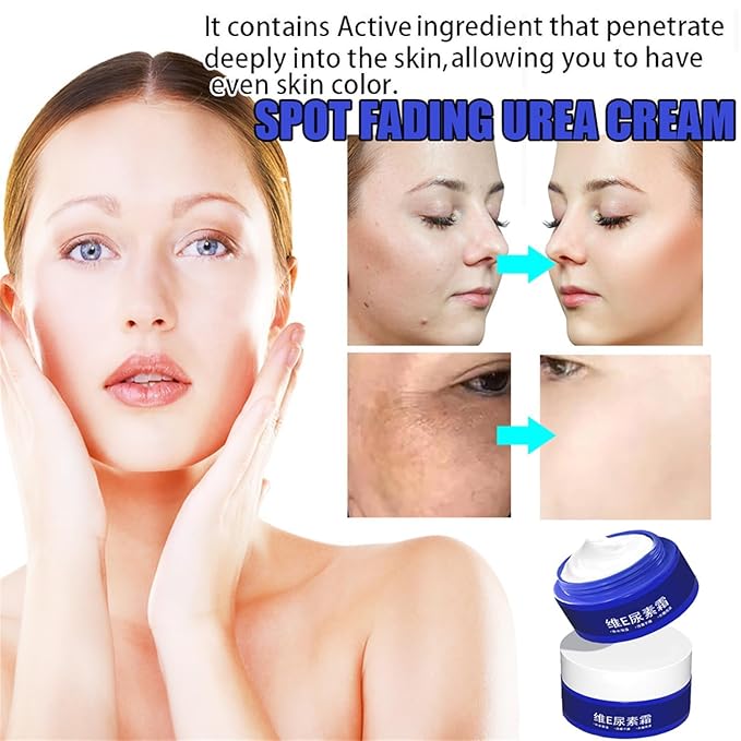 Beautykomi Spot Fading Urea Cream