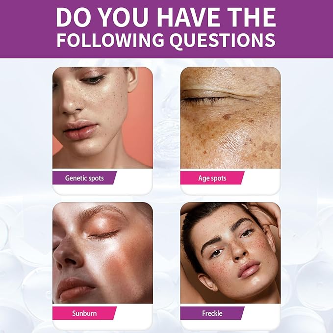 Beautykomi Spot Fading Urea Cream