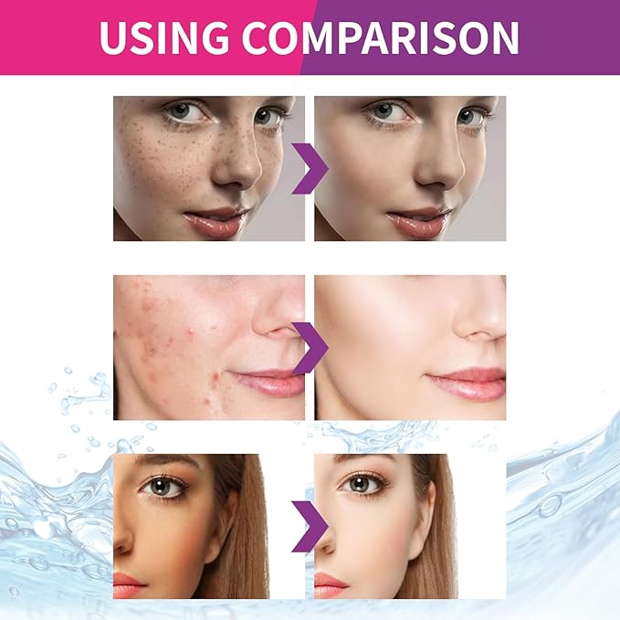 Beautykomi Spot Fading Urea Cream