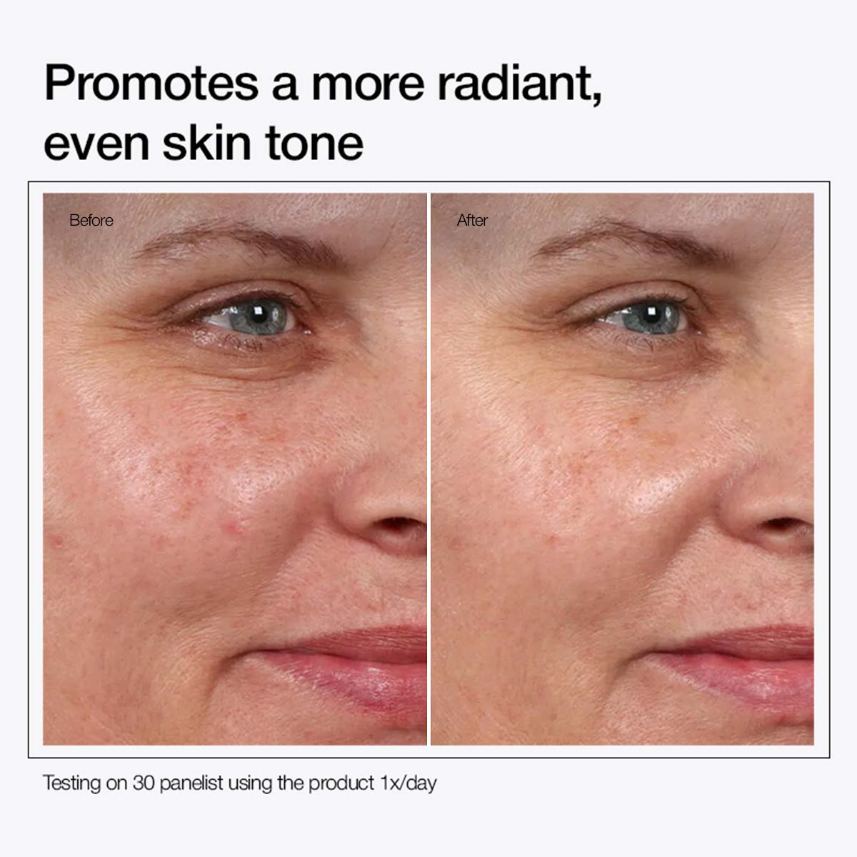 Glycolic Acid 7% Toning Solution - 100 ml