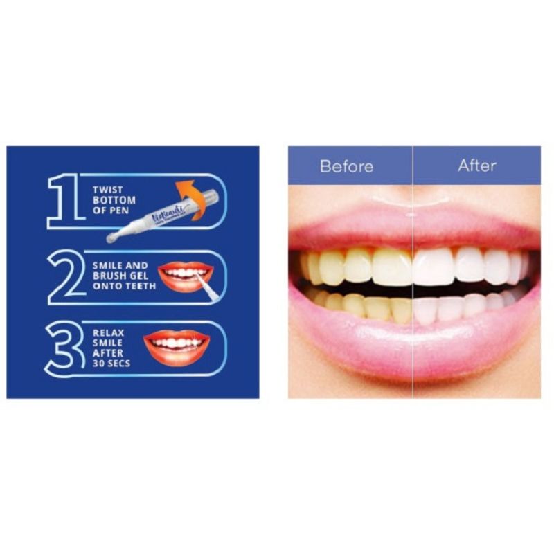 Instant Teeth Whitening Pen - Dazzling White