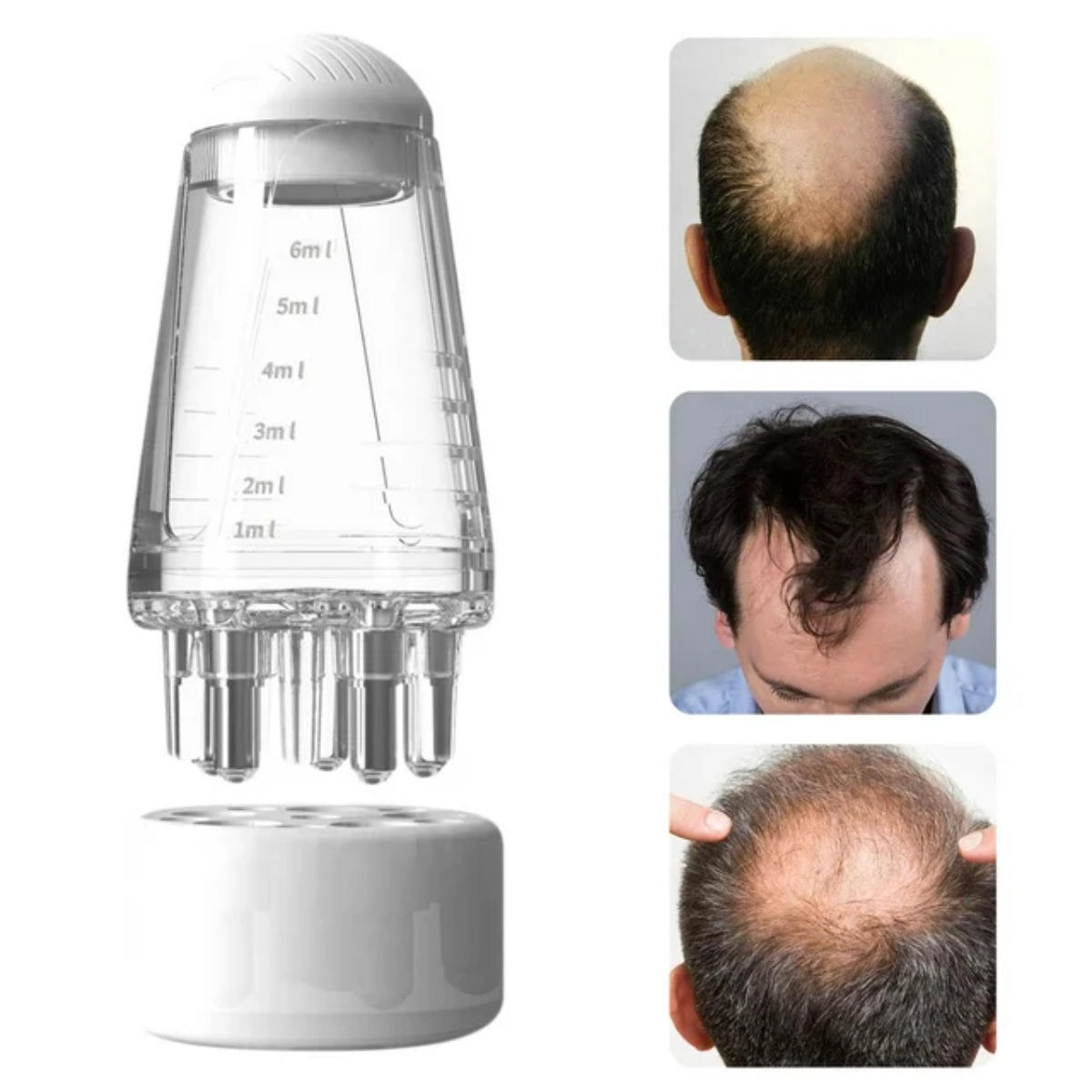 Scalp Oil Applicator with Metal Rollers