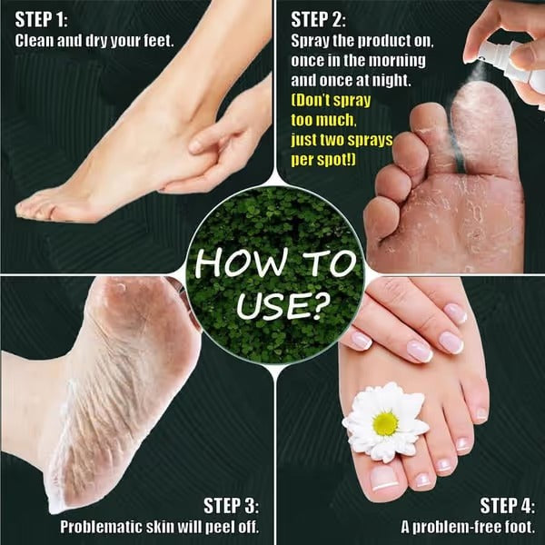🦶 7 Days Ginger Foot Repair Spray™ – Cracked Heel & Dry Foot Care Solution