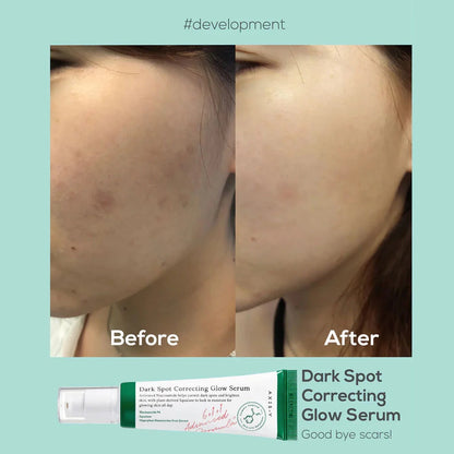 ✨ Axis-Y Dark Spot Correcting Glow Serum (100% Original)