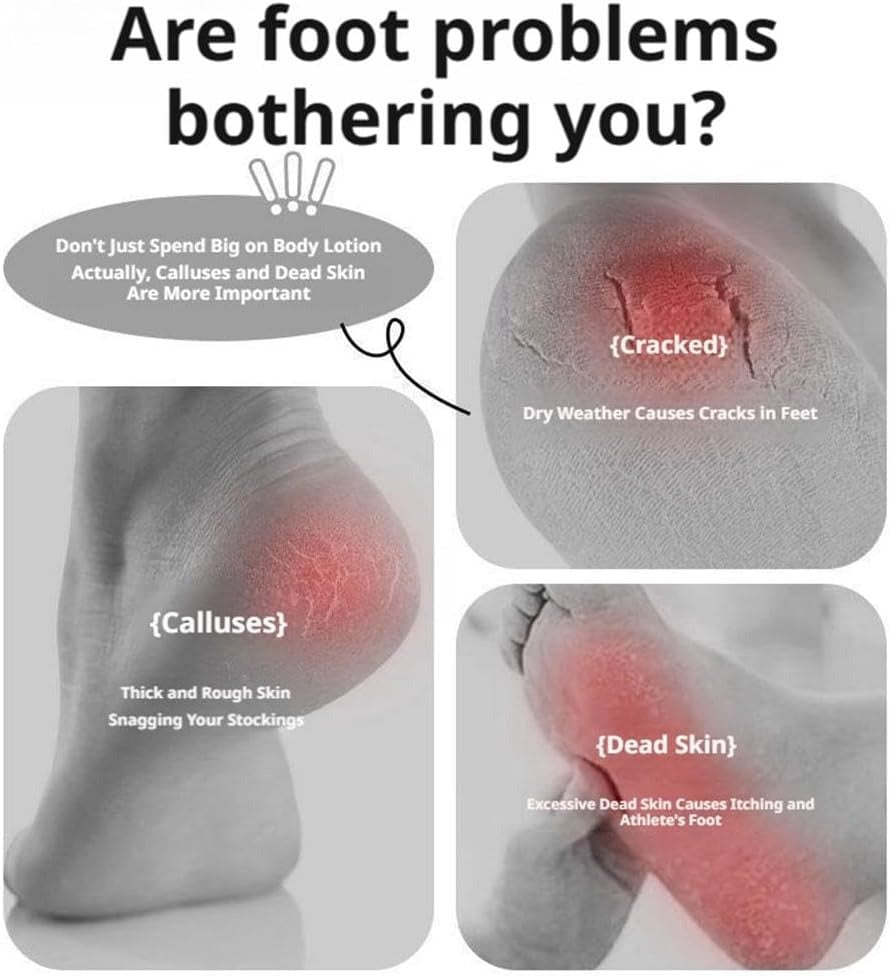 SmoothStep Foot Care Tool