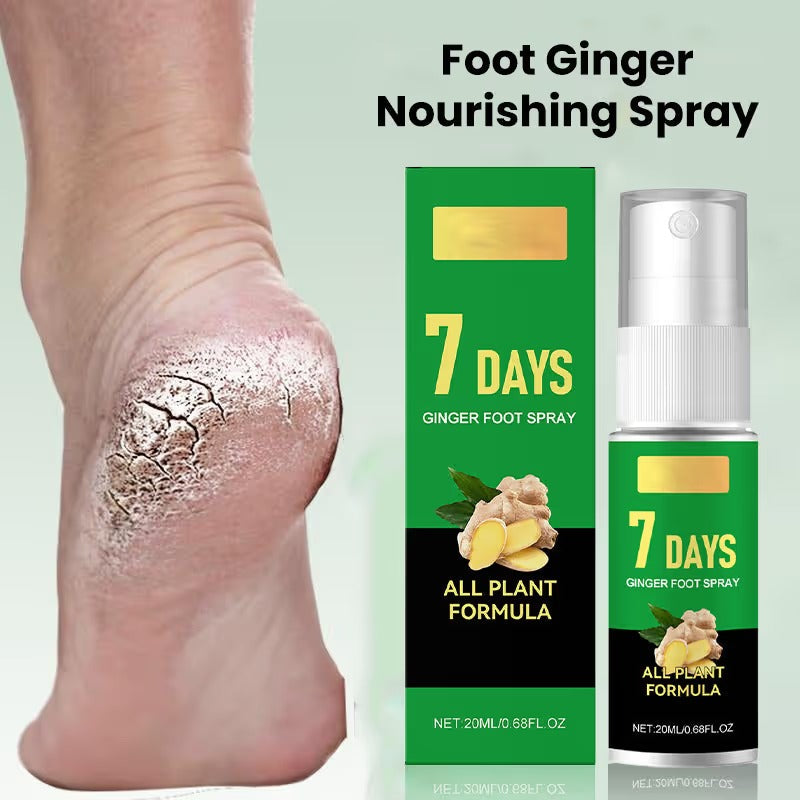 🦶 7 Days Ginger Foot Repair Spray™ – Cracked Heel & Dry Foot Care Solution
